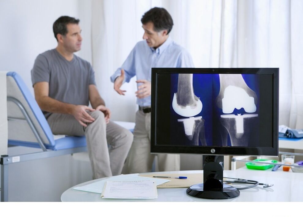 arthrosis of the knee joint in the X -ray image
